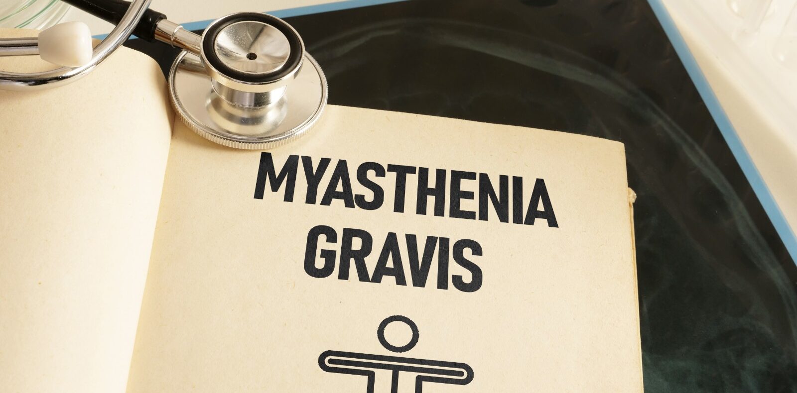Is a Myasthenia Gravis Clinical Trial Right for You? Understanding Your Eligibility for Studies