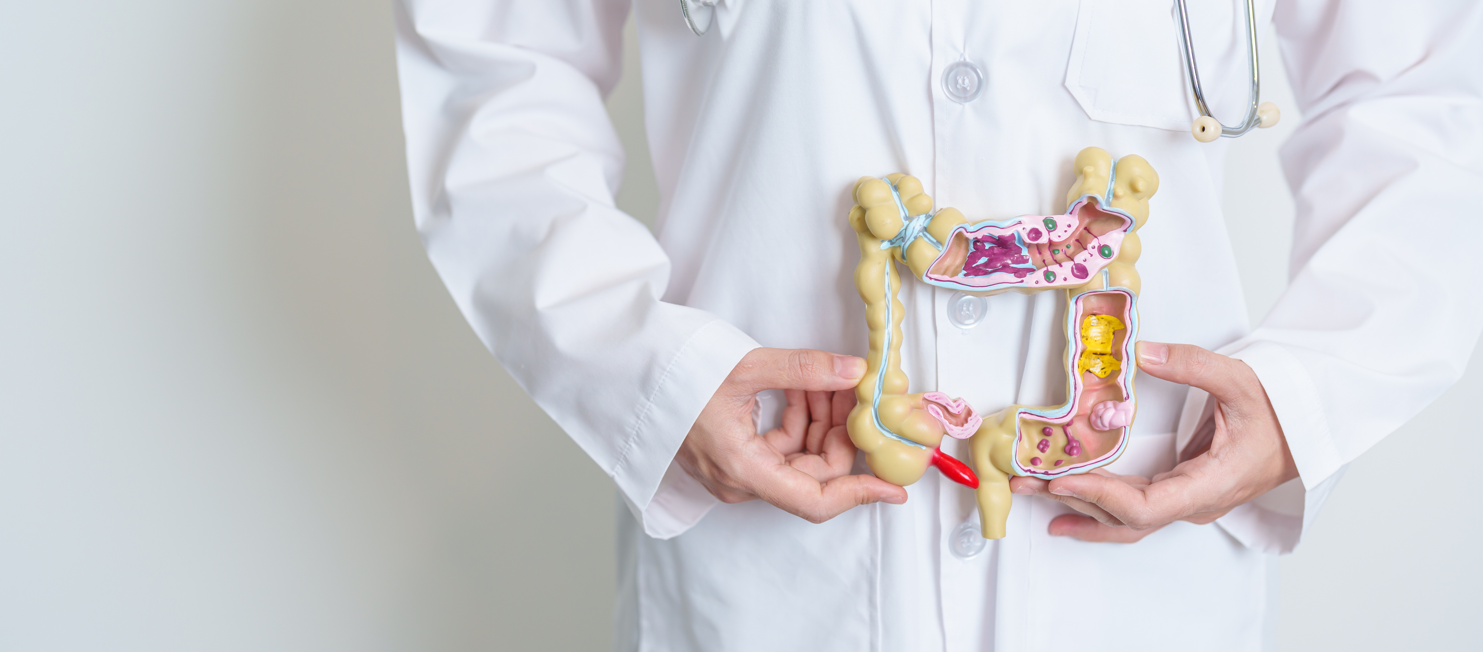Infusion Therapy for Crohn’s Disease: What Providers Should Know
